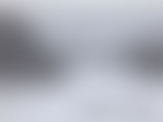 01-07-2023-After and Before