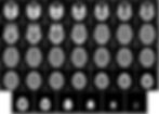 computer-tomography-ga256ccec7_1920.jpg