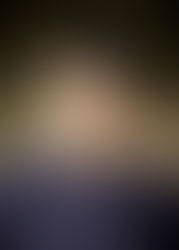 Advancement in the Quantification of Low-Density Lipoprotein Cholesterol