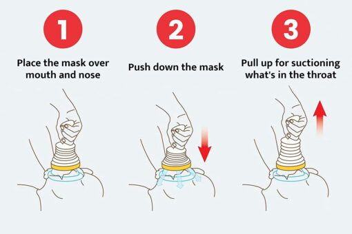 Thumbnail: LifeVac Anti-Choking Device Home Kit