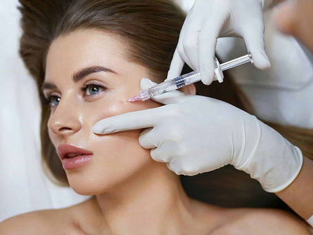 Collagen Biostimulators at SŌMA Bali Compared: Sculptra, Juläine, Juvelook and Radiesse, and When Each Is the Right Choice
