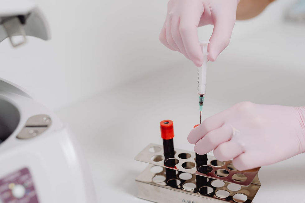 PRP and PRF Preparation 