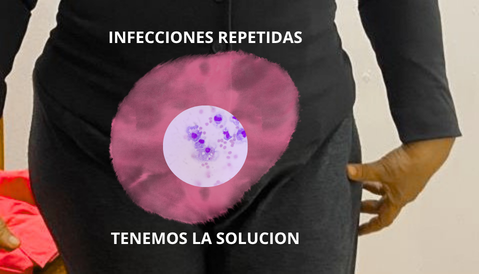 Si tienes infecciones las tratamos de acuerdo a la necesidad, ya sea médica, con laser. exosomas-