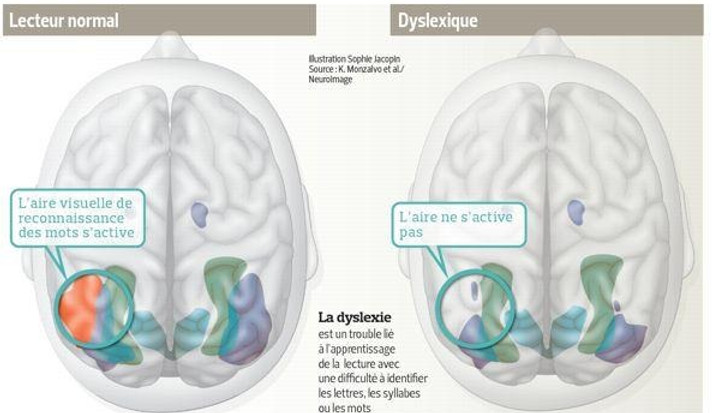 cerveau_edited.jpg