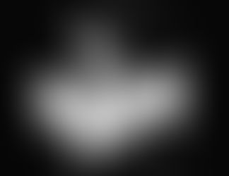 Rides du décolleté que faire