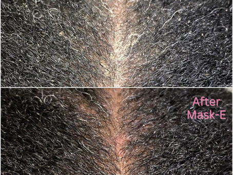 Signs Your Hair May Not Be Low Porosity, Just Build-Up!