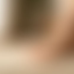 足指の痛み・変形は体のSOS！自宅でできる3つの改善ステップ