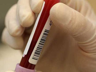 Seu tipo de sangue pode aumentar sua chance de ter Alzheimer