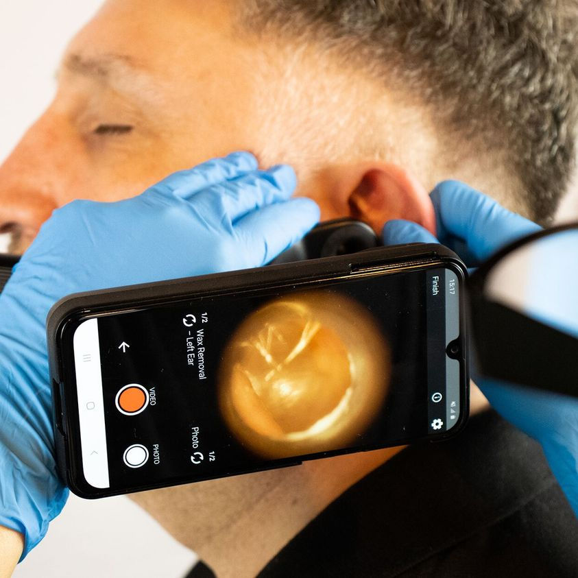 Ear Wax Removal