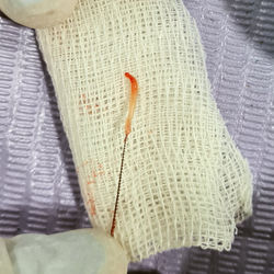 Nerve/Pulp of a tooth!