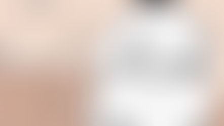 Can Weight Loss Medication (GLP-1 Agonist) Be Used to Treat PCOS and Infertility?