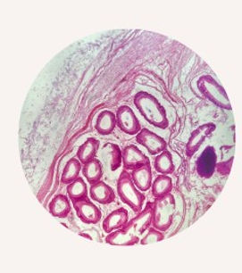 epididimo 1.jpg