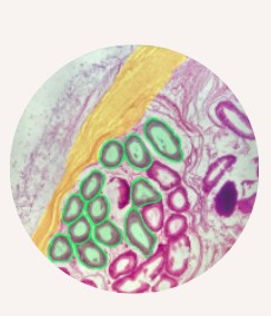 EPIDIDIMO 2.jpg