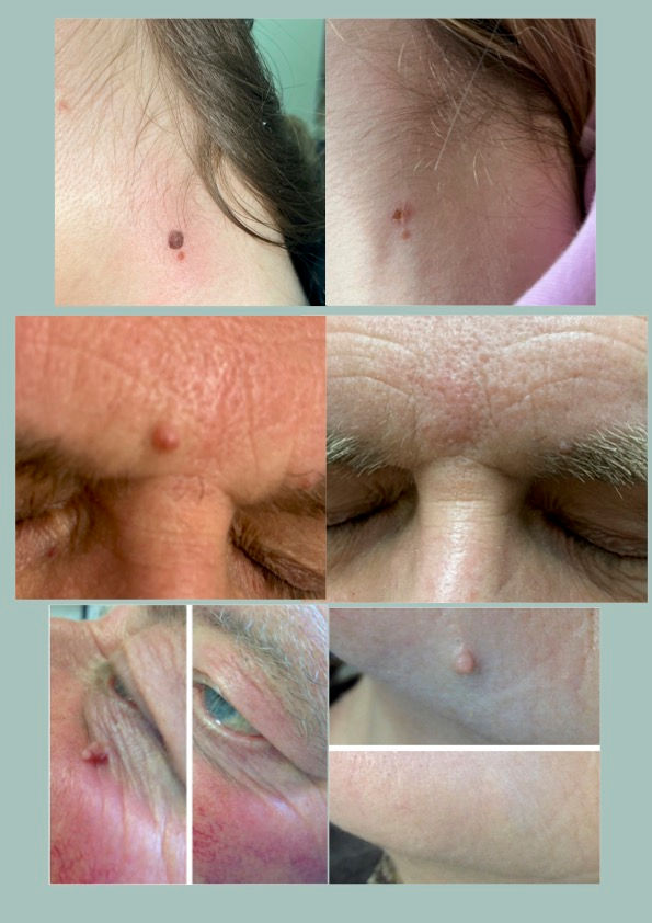 A PAPULES 2A 2026 jpeg.jpg