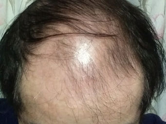 ６３週　戦果報告