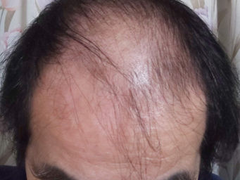 ３０２週　戦況報告