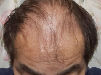 ３２１週　戦況報告