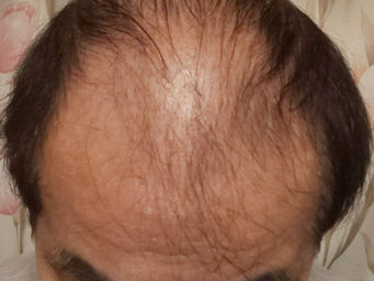 ３４４週　戦況報告