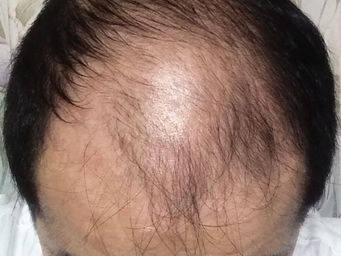 １８７週　戦況報告