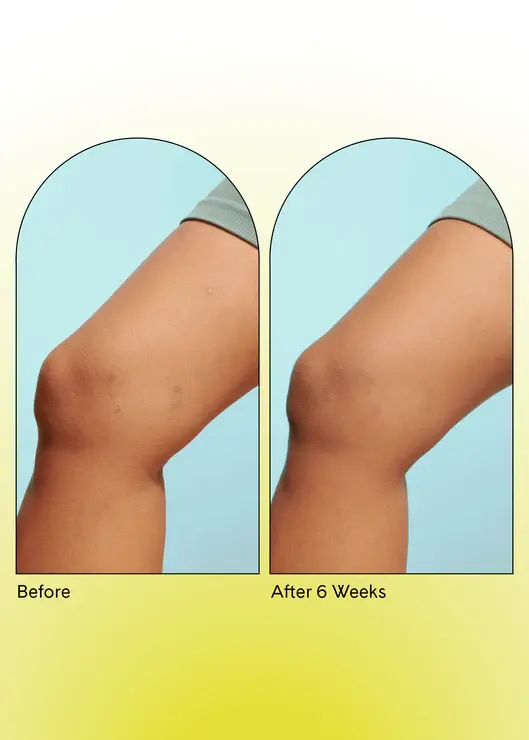 Thumbnail: Silk Scrub