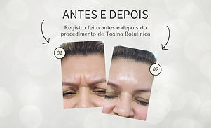Antes e Depois - Dra. Jacqueline.jpg
