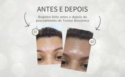 Antes e Depois - Dra. Jacqueline (1)