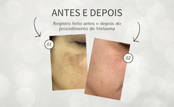 Antes e Depois - Dra. Jacqueline (3)
