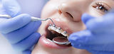 soin d'orthodontie sur jeune femme