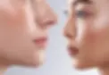 MicroHydra_MH_Faces.webp