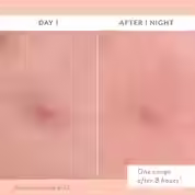 Thumbnail: S.O.S. Totally Invisible Clarifying Liquid Patch