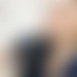 Filler Fears: Myths, Truths, and the Art of Subtle Enhancement in Argyle, TX