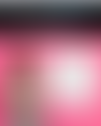 Discover Your Perfect Smile At Our Upcoming Invisalign Day in Yate