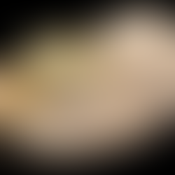 Let's Explore Dental Onlays