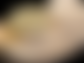 Let's Explore Dental Onlays