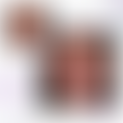 SmileFast Composite Smile Makeover Result