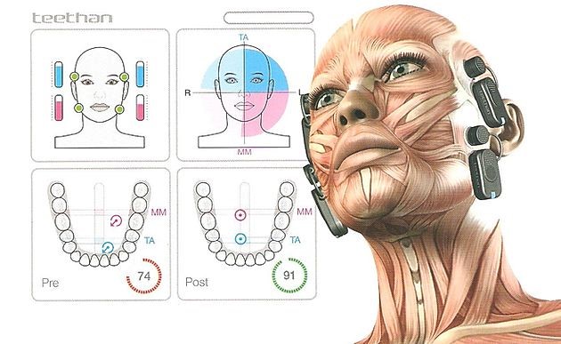 Eletromiografia de superficie para diagnóstico muscular e articular