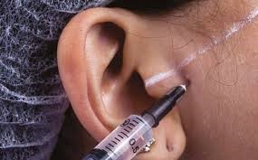 Injeção na ATM de Hialuronato de sódio