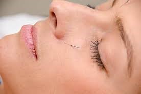 Microagulhamento seco