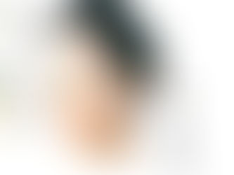 HUYỆT ĐẠO TRÊN MẶT