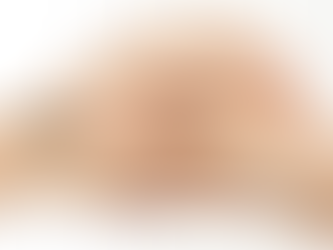 Liệu pháp xoa bóp ngược dòng giảm phù nề bàn tay do chấn thương