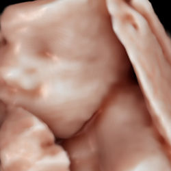 SnuggleScan 3D 32 Weeks