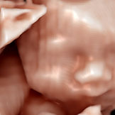 3d 4d ultrasound​ 12