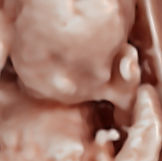 3d 4d ultrasound​ 9