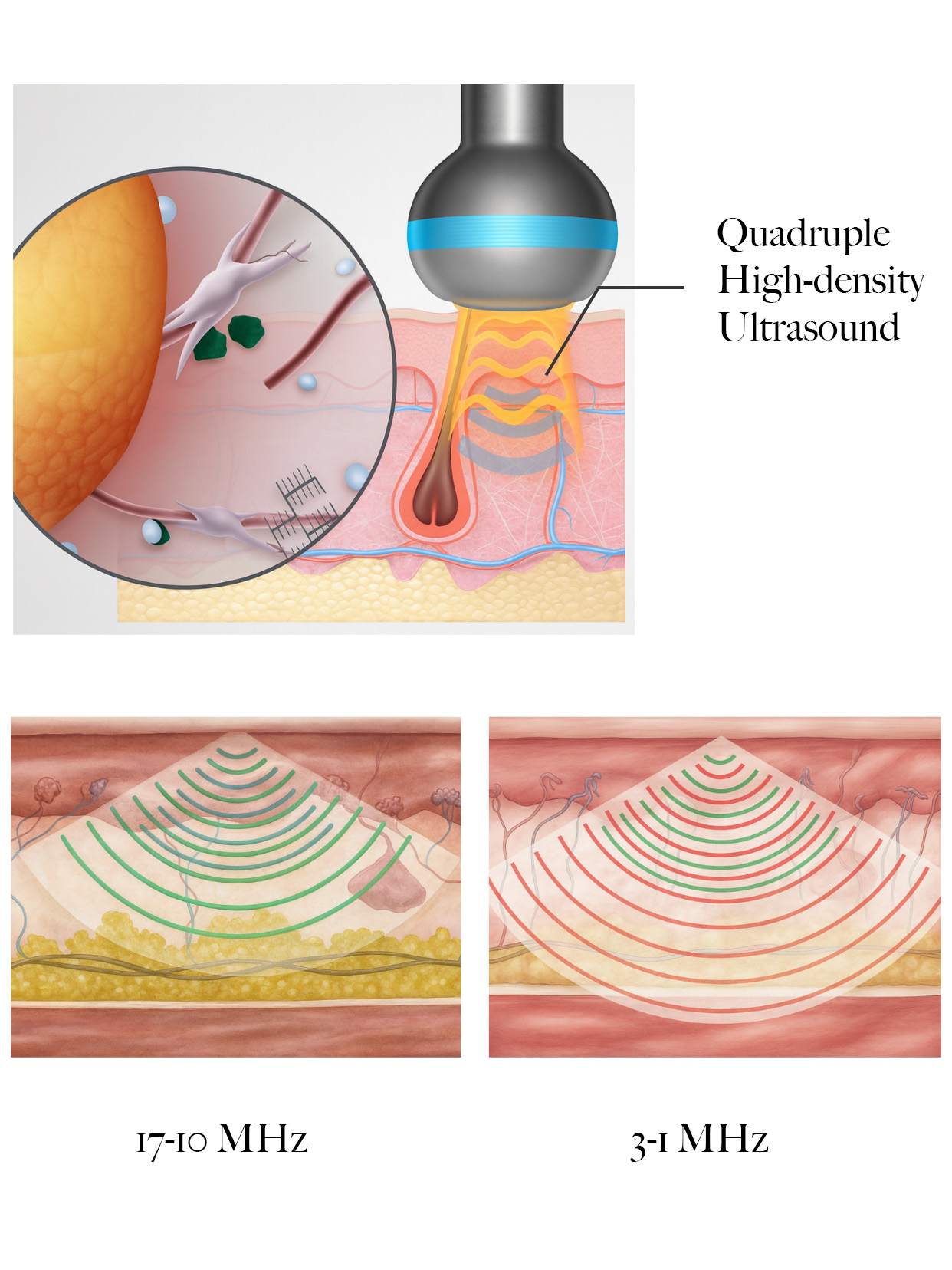 Special skincare session using LDM and plasma technology to refine pores and boost collagen