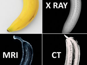 אותה בננה בעיניים שונות (רפואה) 