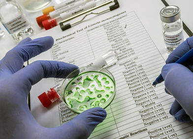 Expert analyzes stuffed meat contaminated by bacterium of listeria in laboratory, sprout c