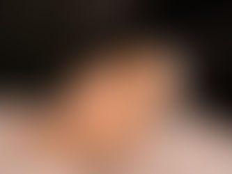 Chemical Peel Guide: How It Works, What to Expect, and Post-Treatment Skincare