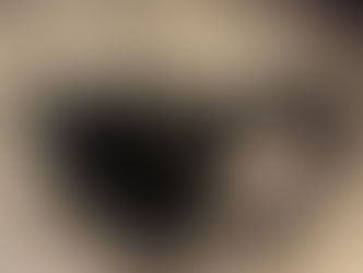 Matapo, our blind kitty, needs your help