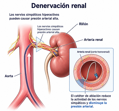 denervacion-renal-merida-yucatan