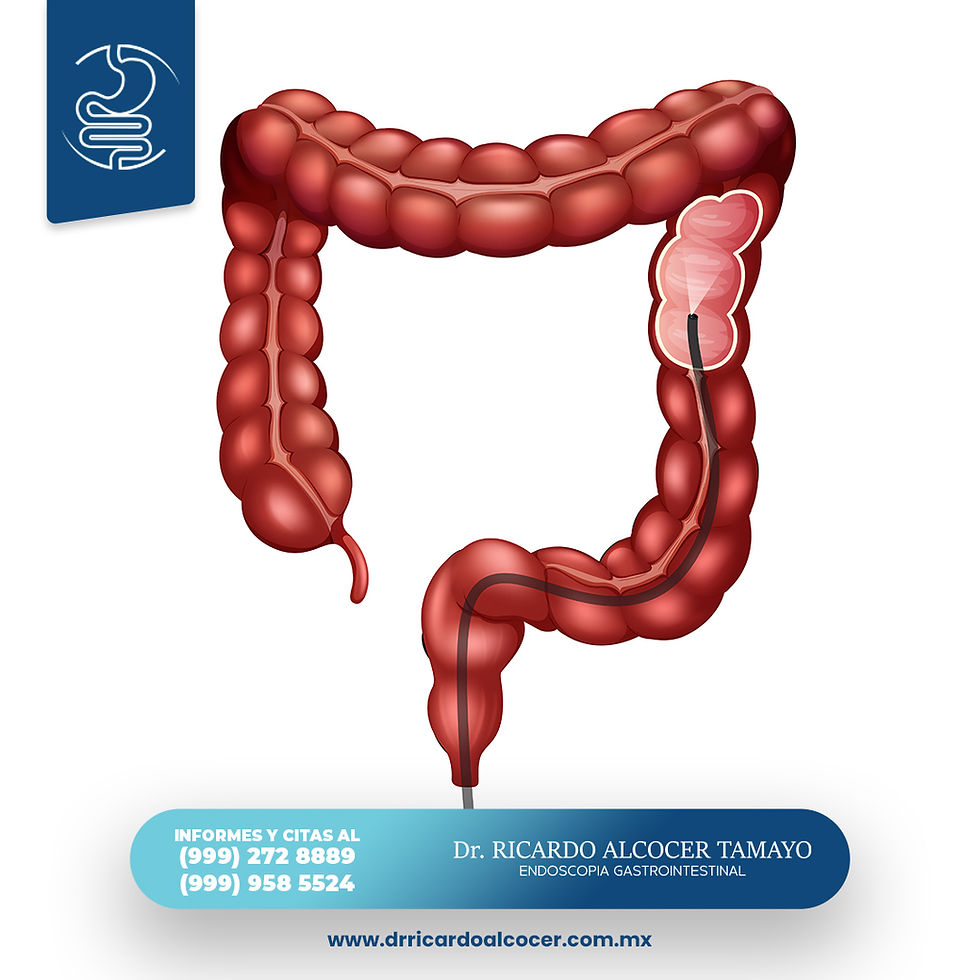 Colonoscopy Dr. Ricardo Alcocer Tamayo
